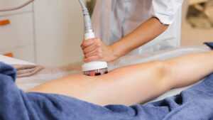 5 Key Insights How Shockwave Therapy Transforms Recovery